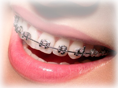 1414666872_orthodontie_ilu