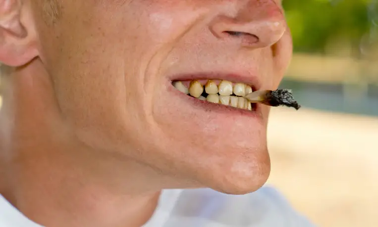 Teeth Stains and Discolorations Causes and how to fix