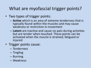 trigger points