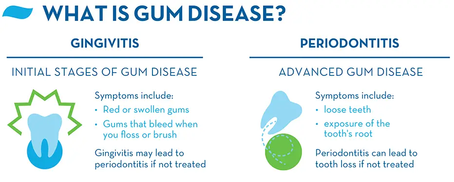 what-is-gingivitis-gum-disease-and-periodontitis