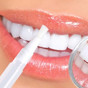 whitening lightning super booster teeth whitening pens reviews