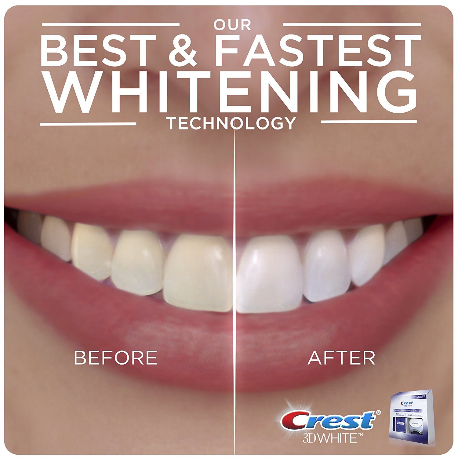 Best Whitening Strips Review 2020 - DentalsReview