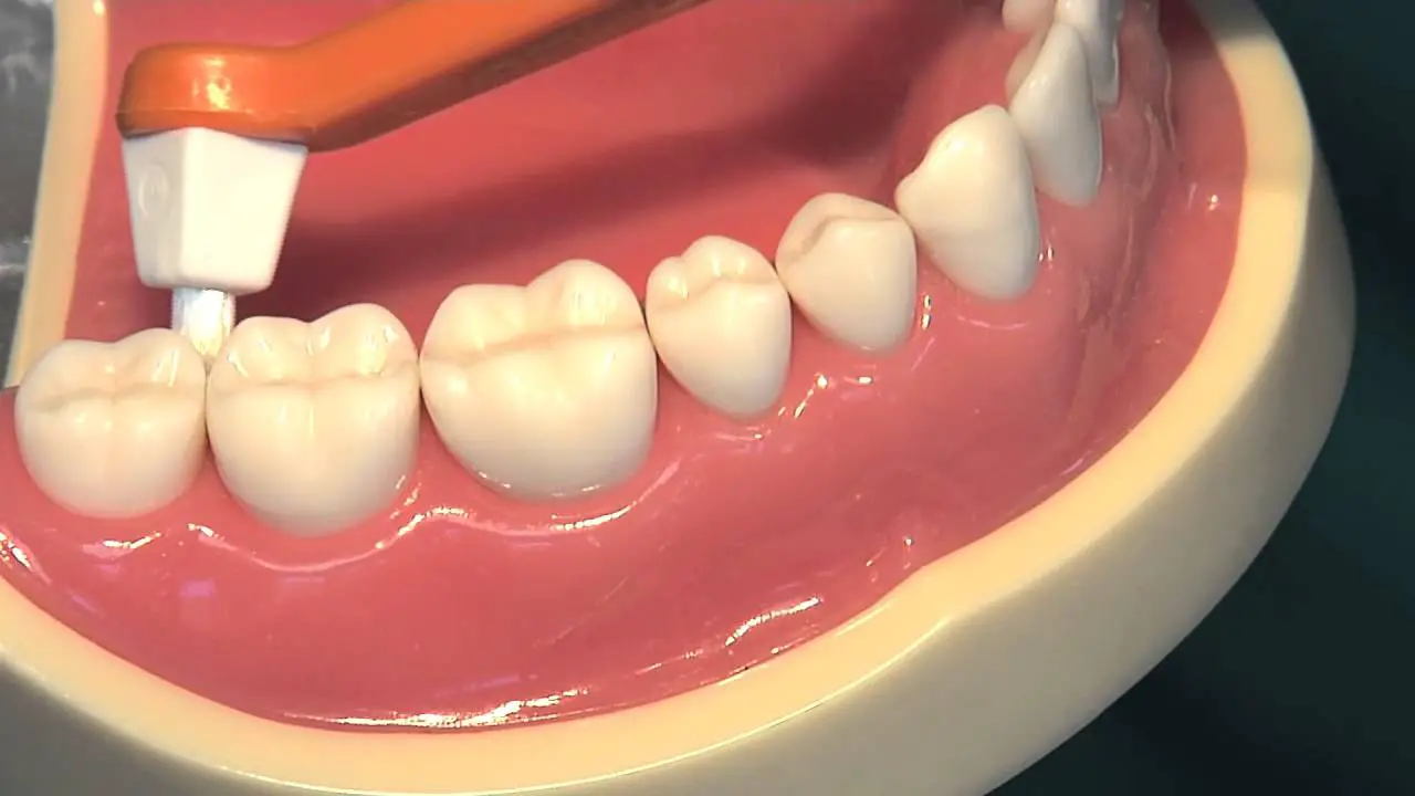 Sulcabrush - an effective teeth flossing alternative ...