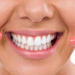 The beautiful smile can be obtained. Homemade solutions by lightening the teeth naturally.