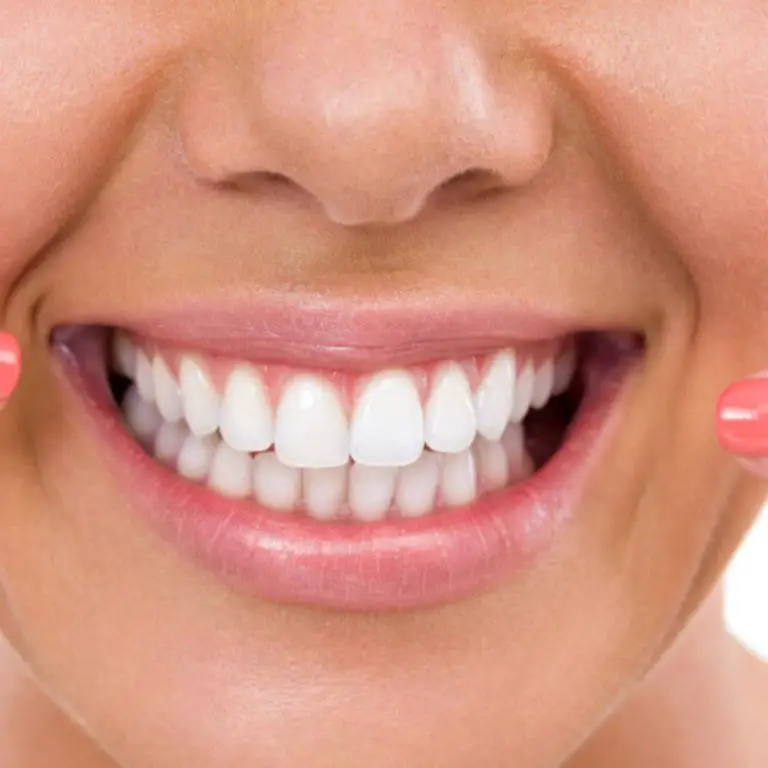 Natural Teeth Whitening Tips & Tricks To Get Rid of Yellow Teeth