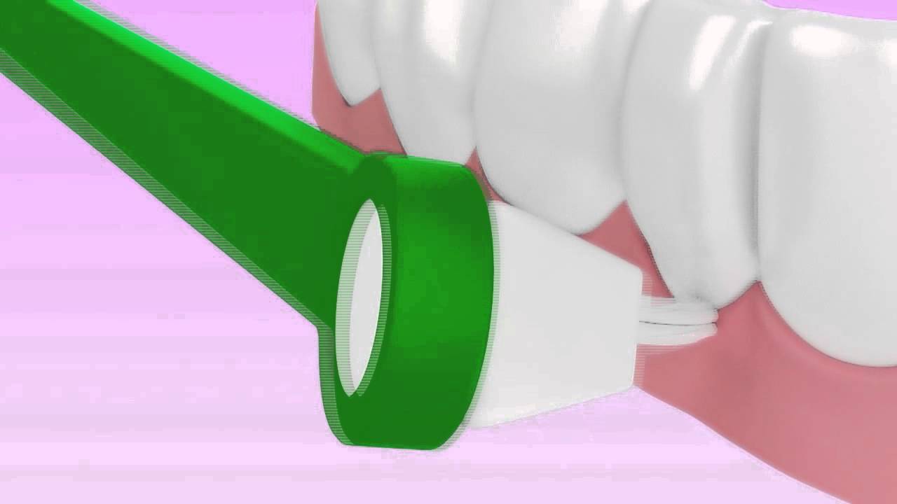 Sulcabrush an effective teeth flossing alternative DentalsReview